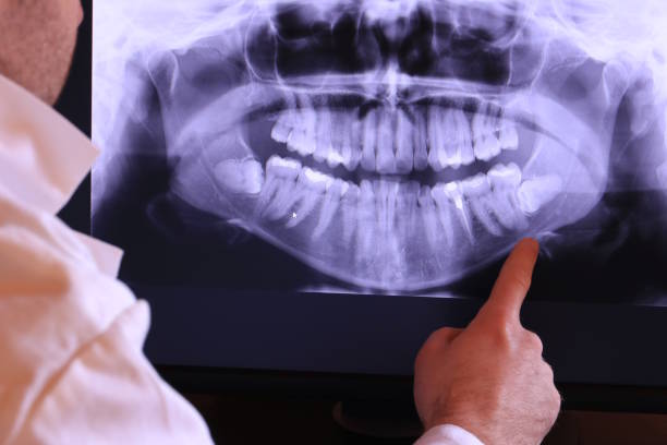 Best Cosmetic Emergency Dentistry in Burnettown, SC